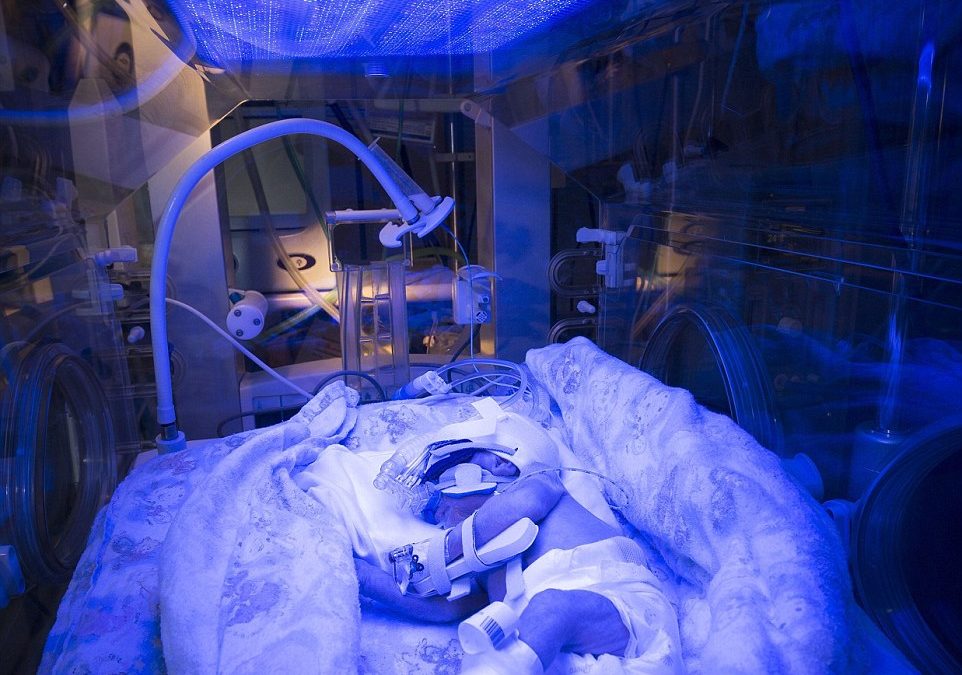 Medical miracle: Extraordinary image showing premature baby receiving light therapy